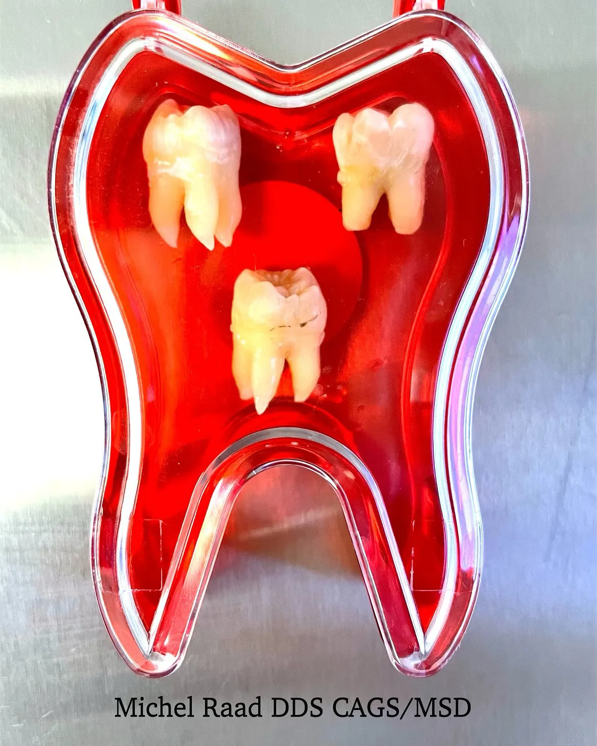 Wisdom Teeth Display